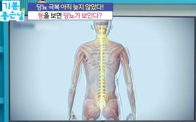 등을 보면 당뇨가 보인다 3 image 3