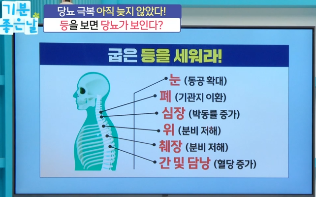 등을 보면 당뇨가 보인다? 혈당 관리의 핵심은 '척추'! 6 image