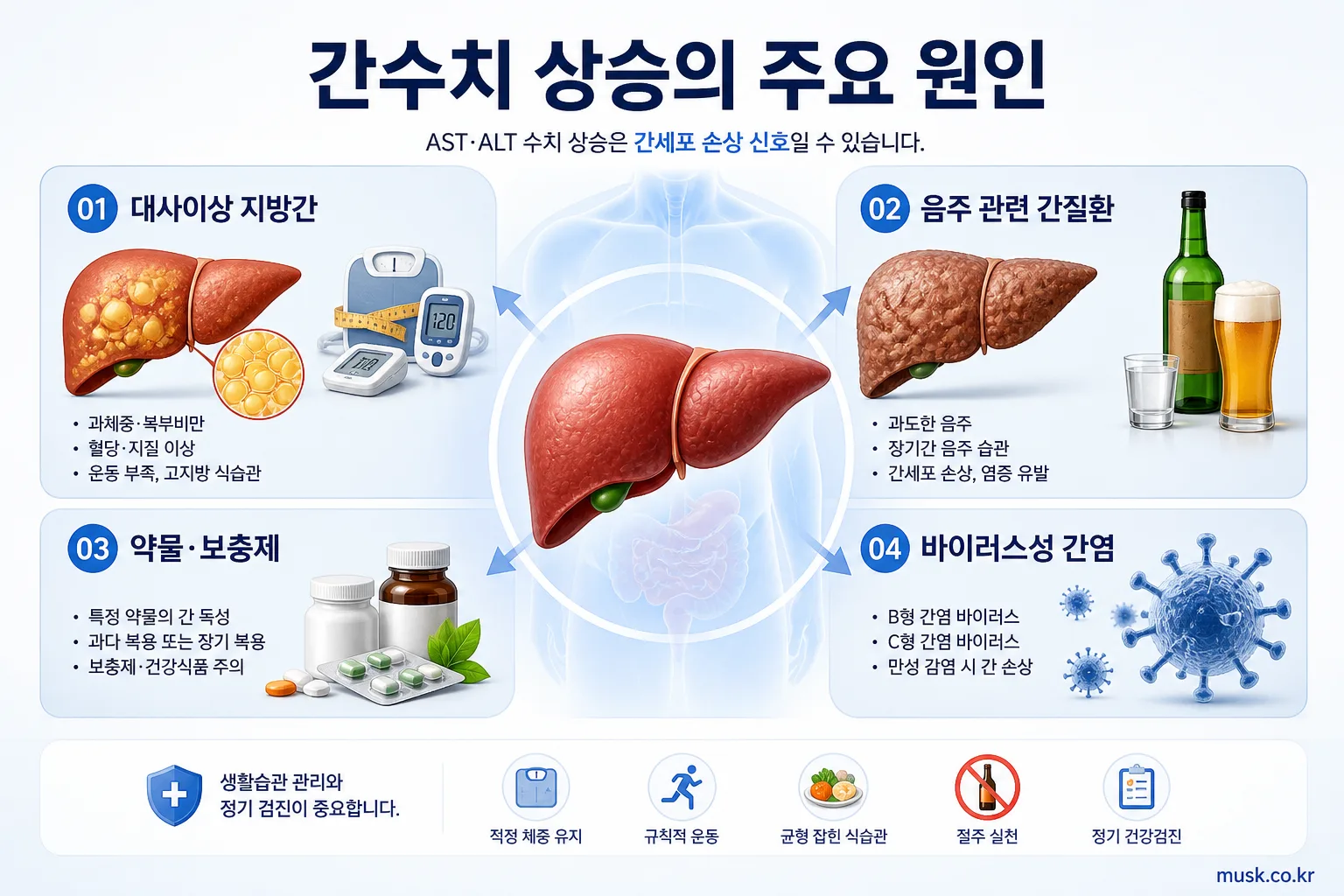 대사이상 지방간과 음주, 약물, 바이러스성 간염 등 간수치 상승 주요 원인