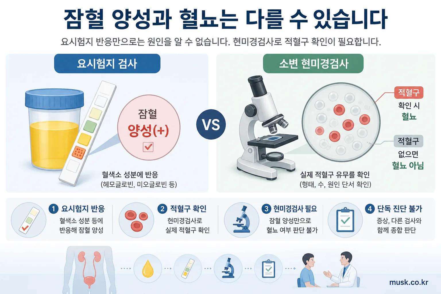 소변검사에서 잠혈 양성이 나오는 이유와 확인할 검사 5 요시험지 잠혈 양성과 소변 현미경검사의 차이를 설명하는 이미지