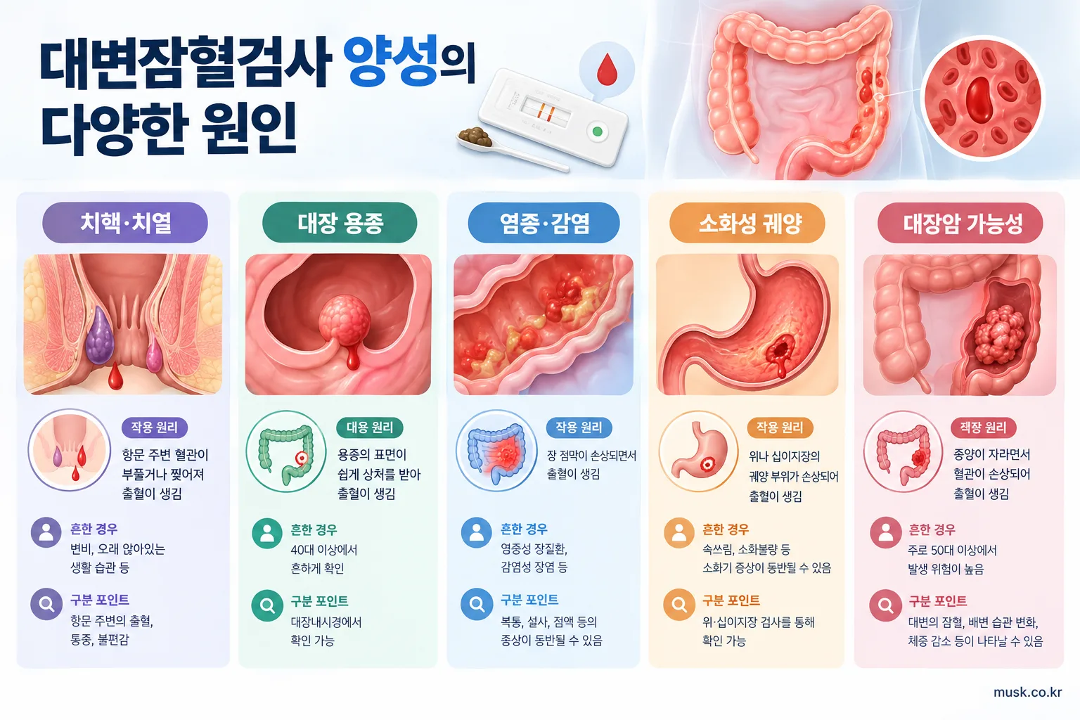 대변잠혈검사 양성을 일으킬 수 있는 다양한 원인