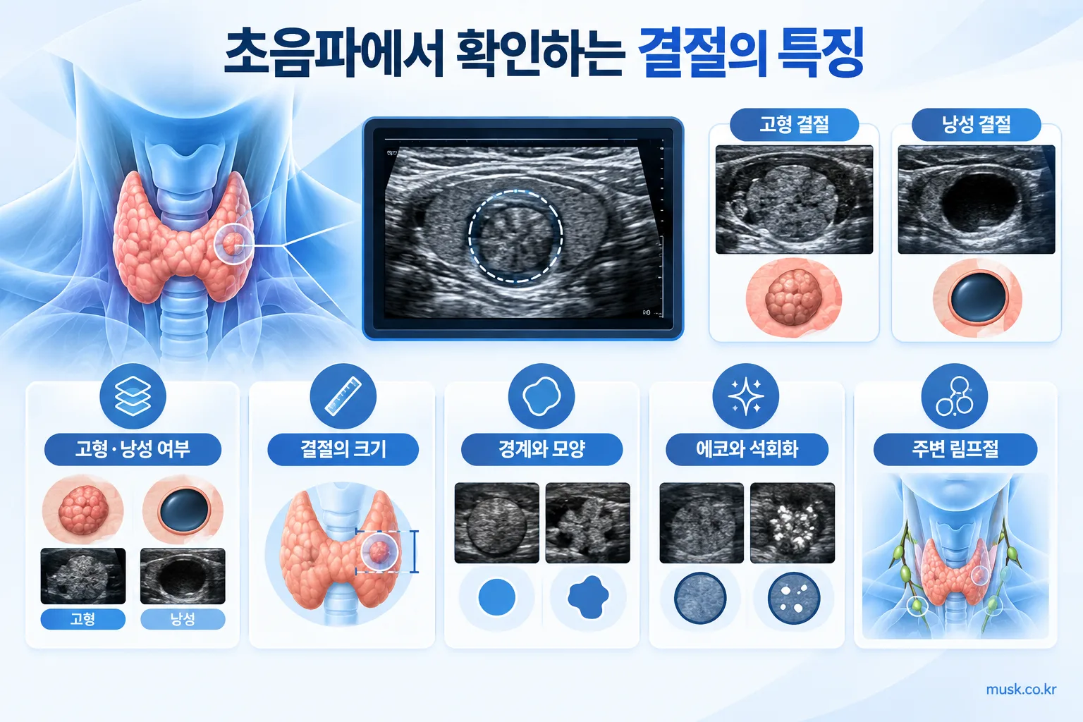 갑상선 초음파에서 결절이 보이면 무슨 뜻인가 2 갑상선 초음파에서 결절의 고형성, 낭성, 경계와 모양을 평가하는 설명 이미지