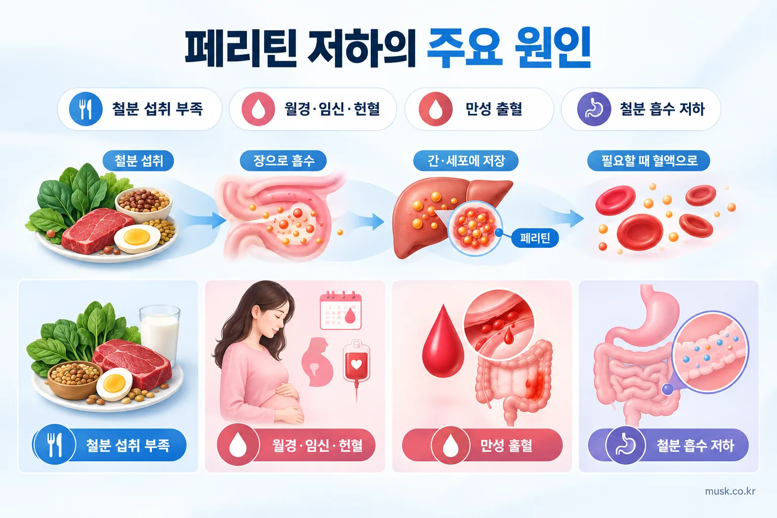 혈액검사에서 페리틴 수치가 낮게 나오는 이유 2 철분 섭취 부족과 출혈 및 흡수장애 등 페리틴 저하 원인을 보여주는 이미지