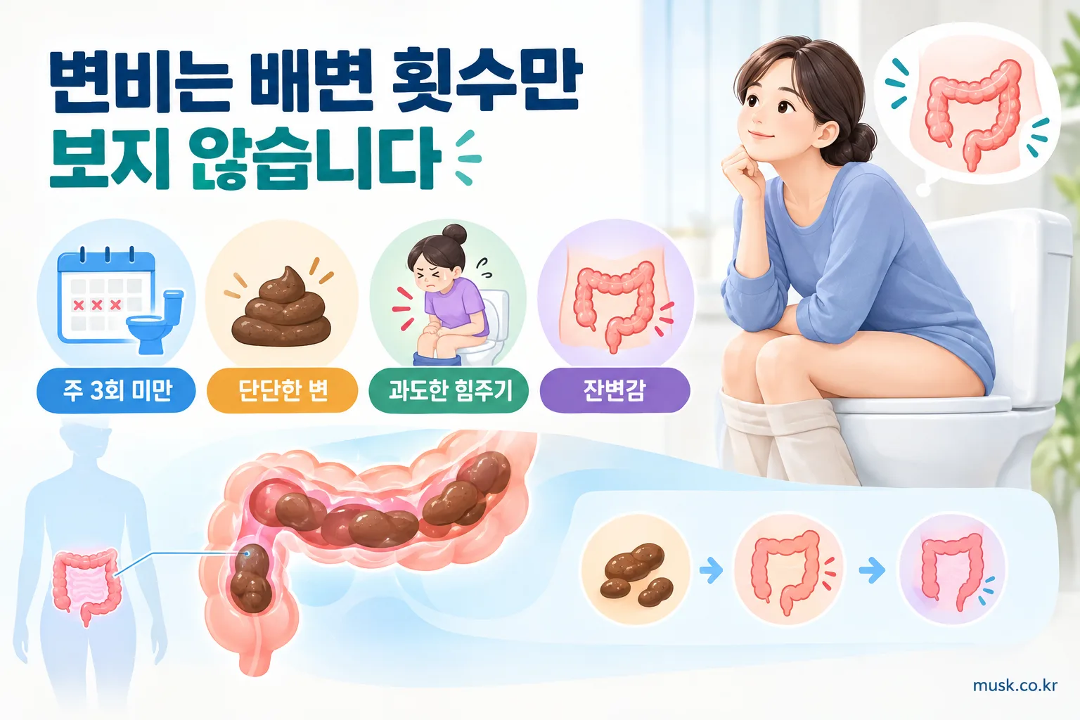 며칠에 한 번 대변을 보면 변비일까? 배변 횟수와 변비 기준 알아보기 2 변비 판단 시 배변 횟수와 변의 상태 및 배변 불편감을 함께 확인하는 이미지