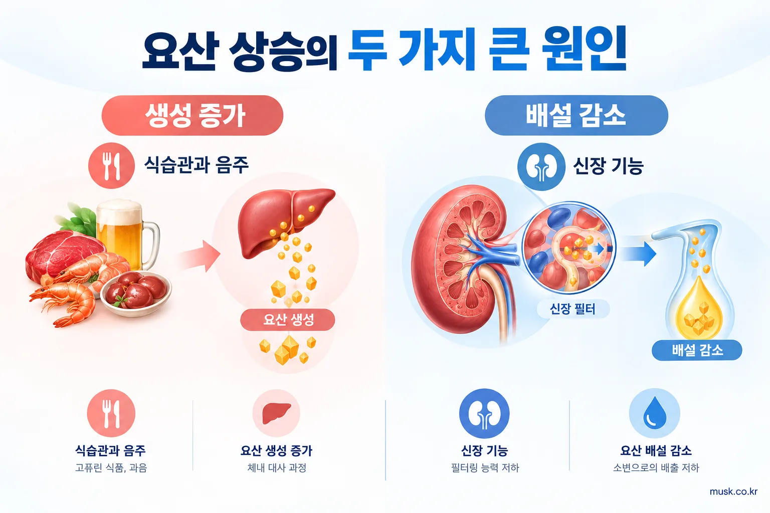 요산 수치가 높은 이유와 검사 결과를 해석할 때 확인할 점 2 요산 생성 증가와 신장 배설 감소를 설명하는 인포그래픽