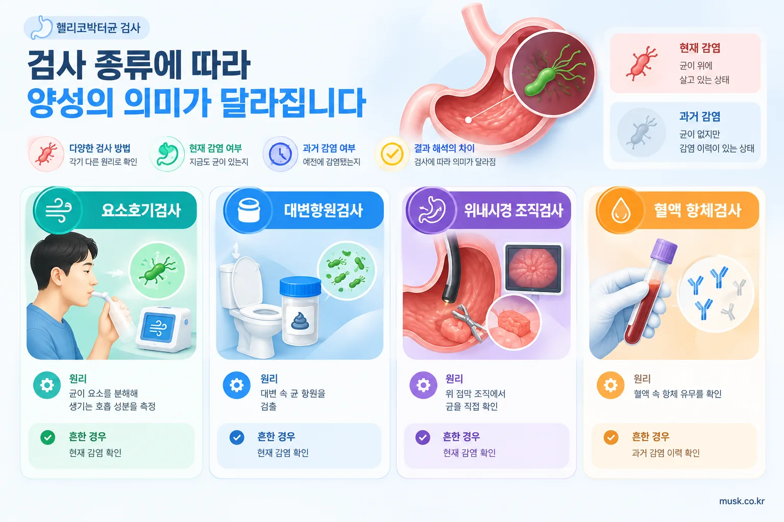 헬리코박터균 검사에서 양성이 나오면 무슨 뜻인가 2 요소호기검사와 대변항원검사, 조직검사, 혈액 항체검사의 차이를 보여주는 인포그래픽