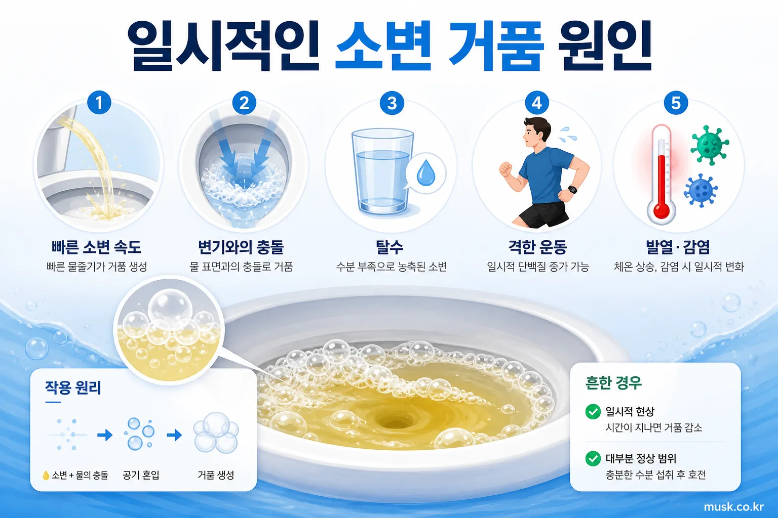 소변에 거품이 생기는 이유, 일시적인 현상과 단백뇨 구분하기 2 소변 속도, 탈수, 운동과 감염으로 생길 수 있는 일시적인 소변 거품 원인