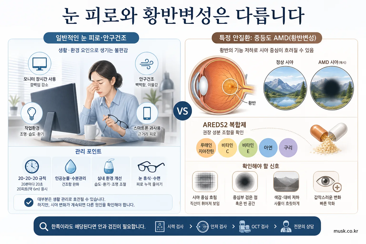 루테인 지아잔틴은 눈 건강에 도움이 되나? 연구 근거와 한계 6 모니터 눈 피로와 중등도 황반변성 및 AREDS2 복합제를 구분한 이미지