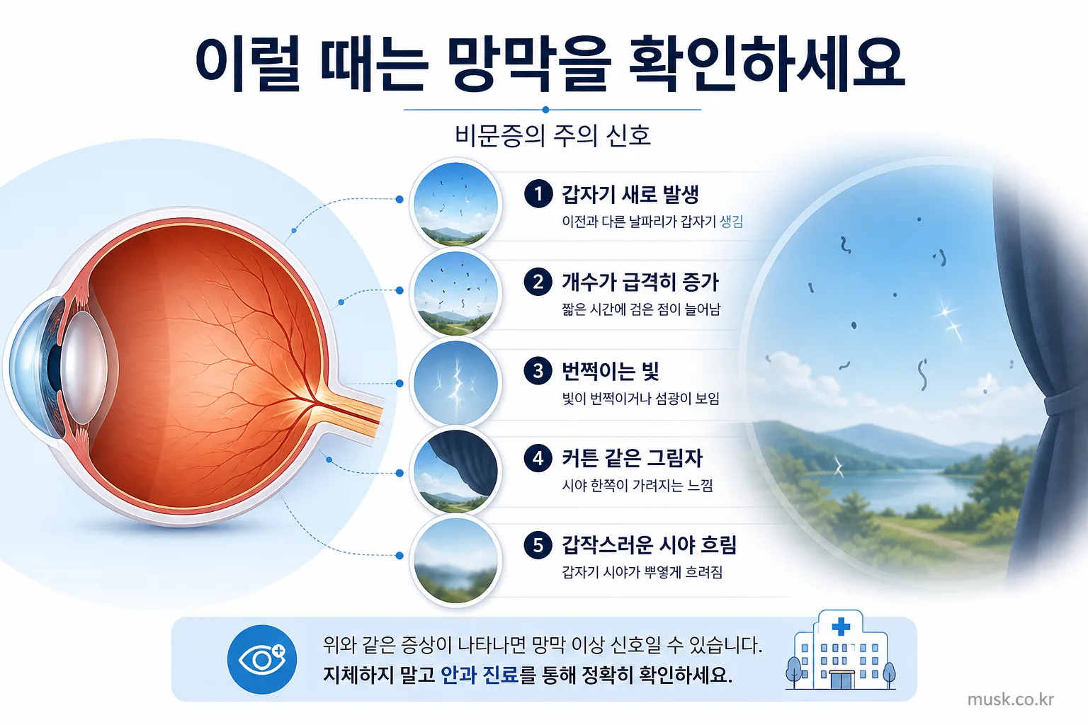 갑작스러운 비문증과 번쩍임 및 시야 가림 등 안과 확인이 필요한 증상
