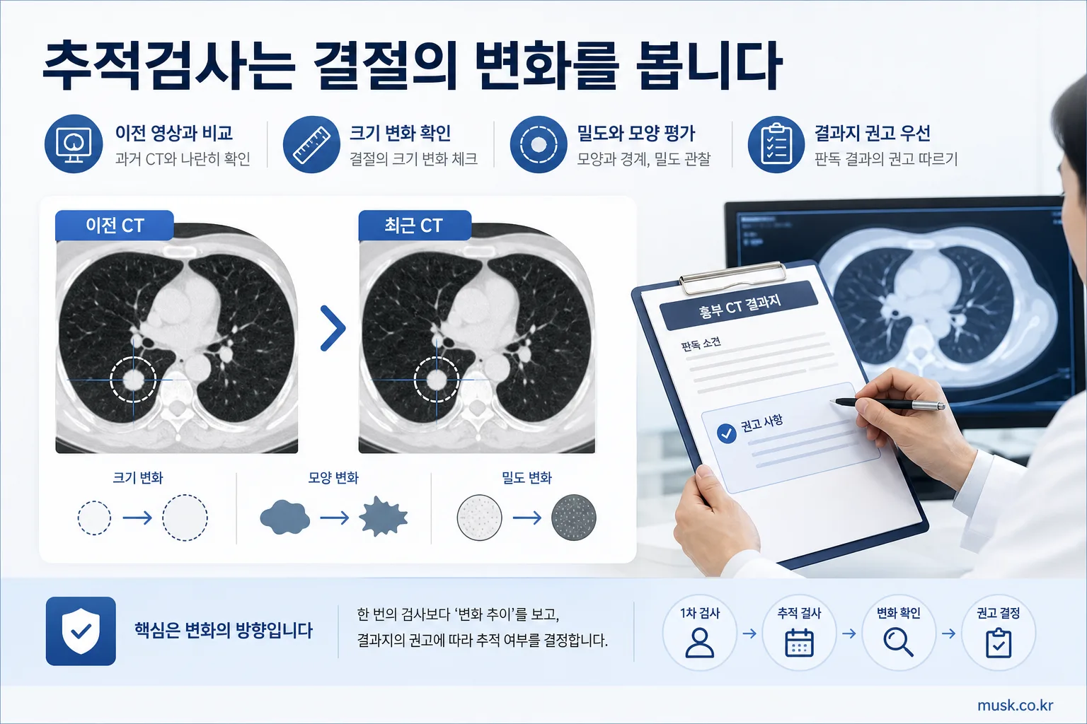 이전 영상과 비교해 폐결절의 변화를 확인하는 추적검사 이미지