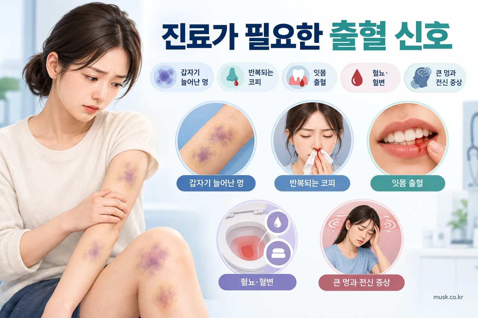 별다른 이유 없이 멍이 잘 드는 이유는 무엇일까 3 갑자기 늘어난 멍과 코피, 잇몸 출혈, 혈뇨와 혈변 등 진료가 필요한 출혈 신호 인포그래픽