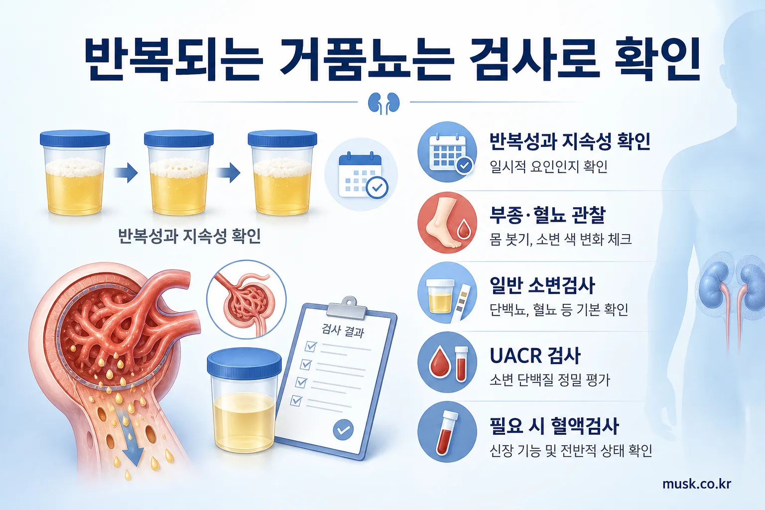 소변에 거품이 생기는 이유, 일시적인 현상과 단백뇨 구분하기 3 반복되는 거품뇨를 확인하기 위한 소변검사와 알부민-크레아티닌 비율 검사