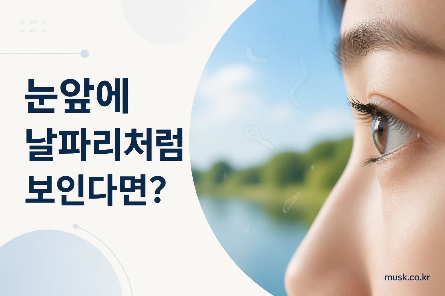 눈앞에 검은 점과 실오라기가 떠다니는 비문증 증상