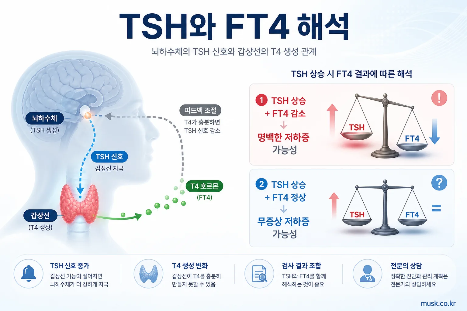 TSH 수치가 높으면 무슨 뜻인가요? FT4와 함께 해석하는 방법 5 TSH 상승과 FT4 결과 조합에 따른 갑상선기능저하증 해석