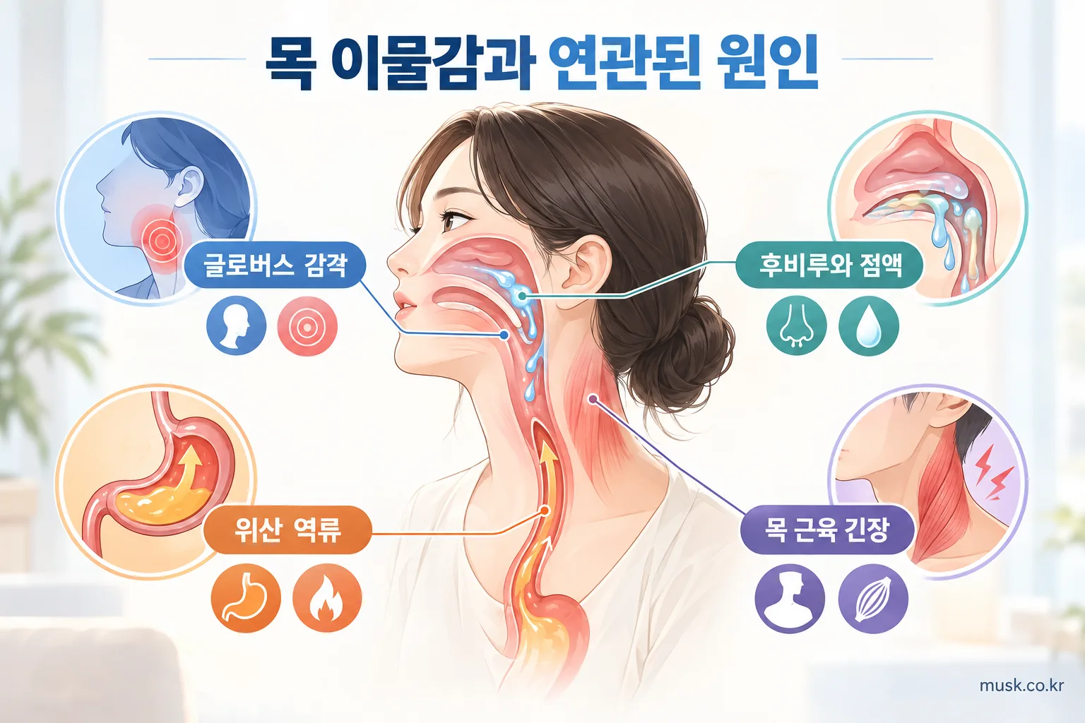 목에 뭔가 걸린 느낌이 계속되는 이유 2 글로버스 감각과 후비루, 위산 역류, 목 근육 긴장 등 목 이물감의 연관 요인