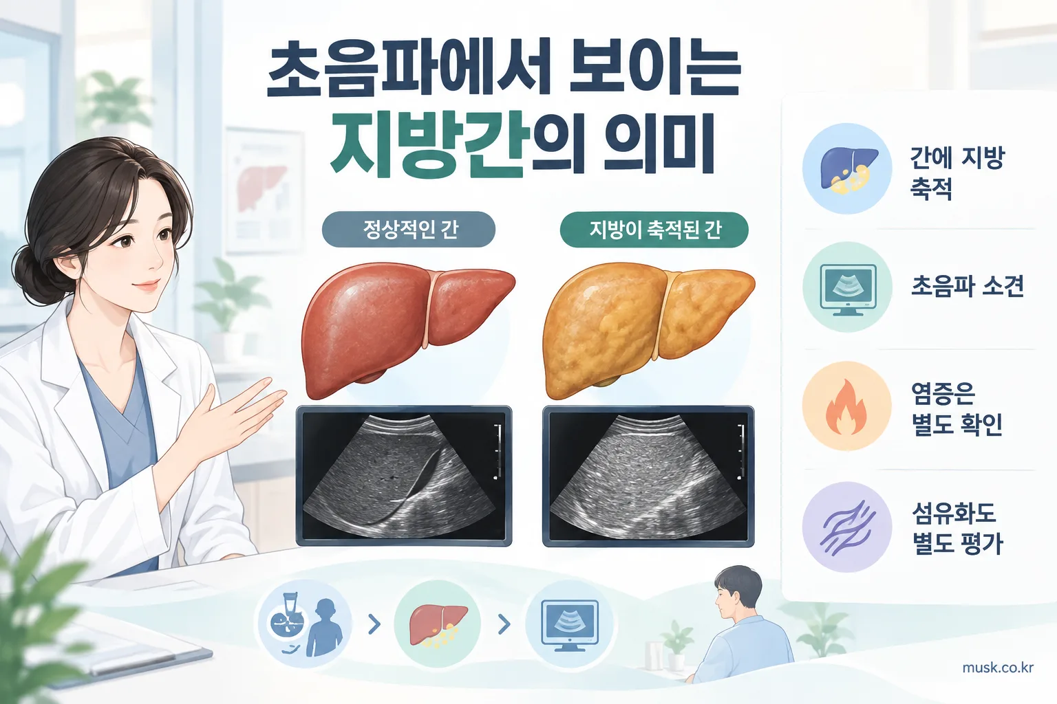 복부초음파에서 간에 지방이 축적된 모습과 추가 평가가 필요한 이유