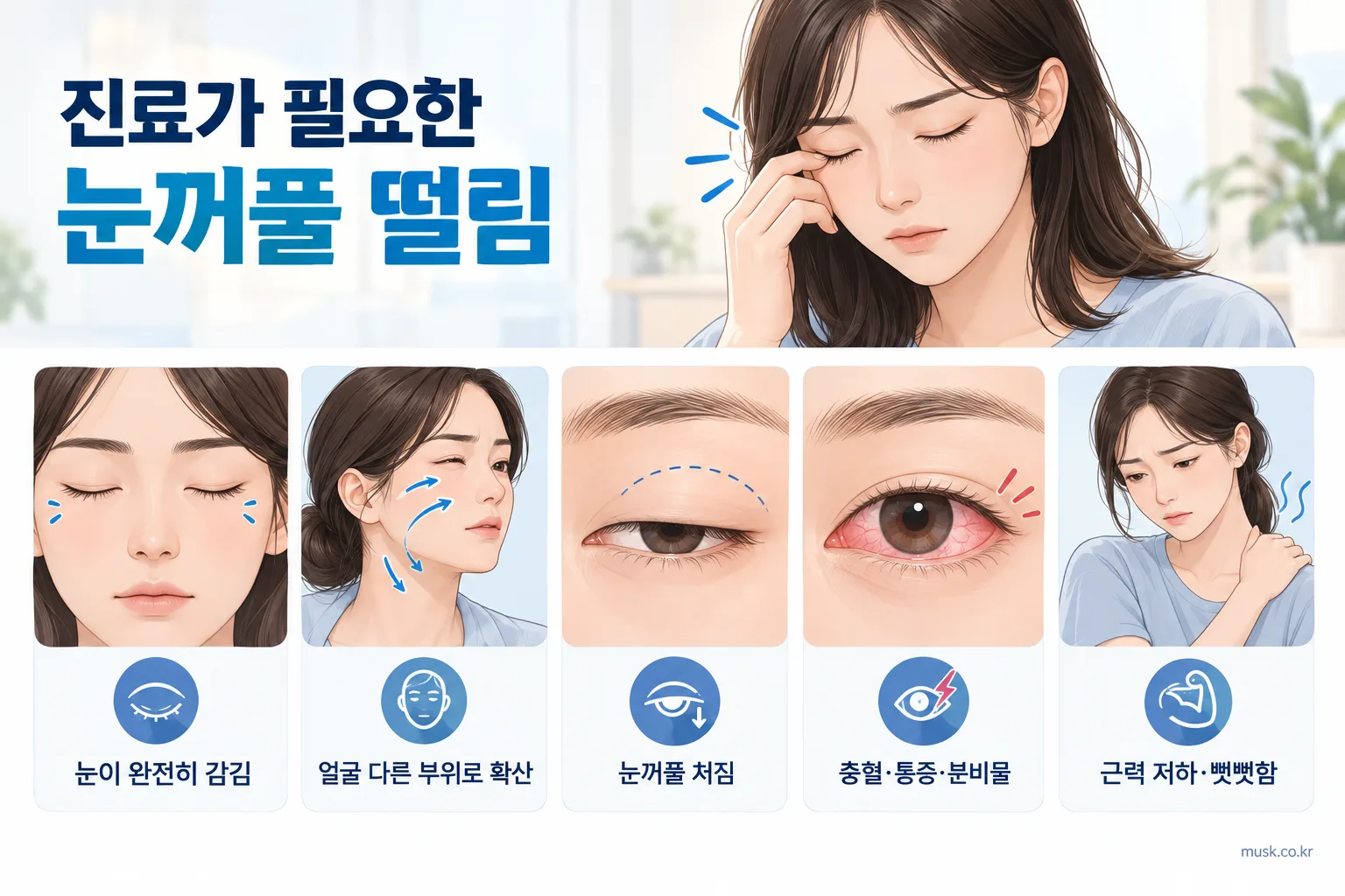 눈꺼풀이 완전히 감기거나 얼굴 다른 부위로 떨림이 퍼지는 등 진료가 필요한 증상