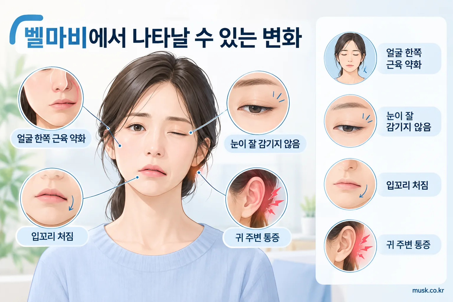 한쪽 얼굴이 갑자기 처지는 이유와 바로 확인해야 할 상황 3 벨마비에서 나타날 수 있는 얼굴 한쪽 근육 약화와 눈 감기 어려움 이미지