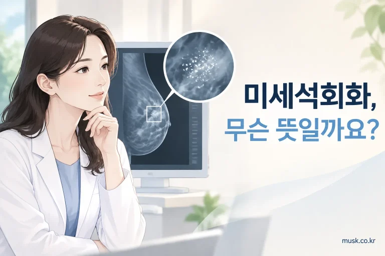 유방촬영술에서 보이는 미세석회화를 설명하는 대표 이미지